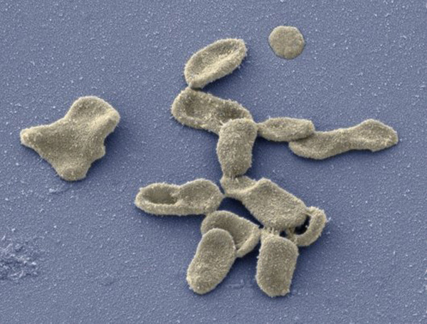 (Image: Thomas Deernick, NCMIR/Science Photo Library)