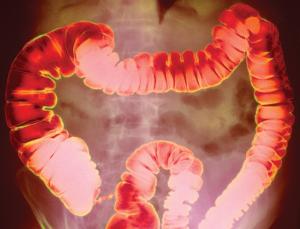 (Image: CNRI/Science Photo Library)