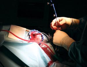 Next time he has a seizure, electrodes will show where (Image: Anil Ananthaswamy)