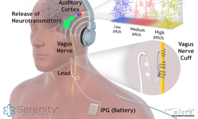 Tinnitus1-640x386[1].jpg